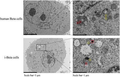 Corrigendum: miR-212/132-enriched extracellular vesicles promote differentiation of induced pluripotent stem cells into pancreatic beta cells